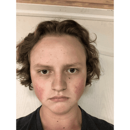 Max Vandorsser, Ontario Landsharks
